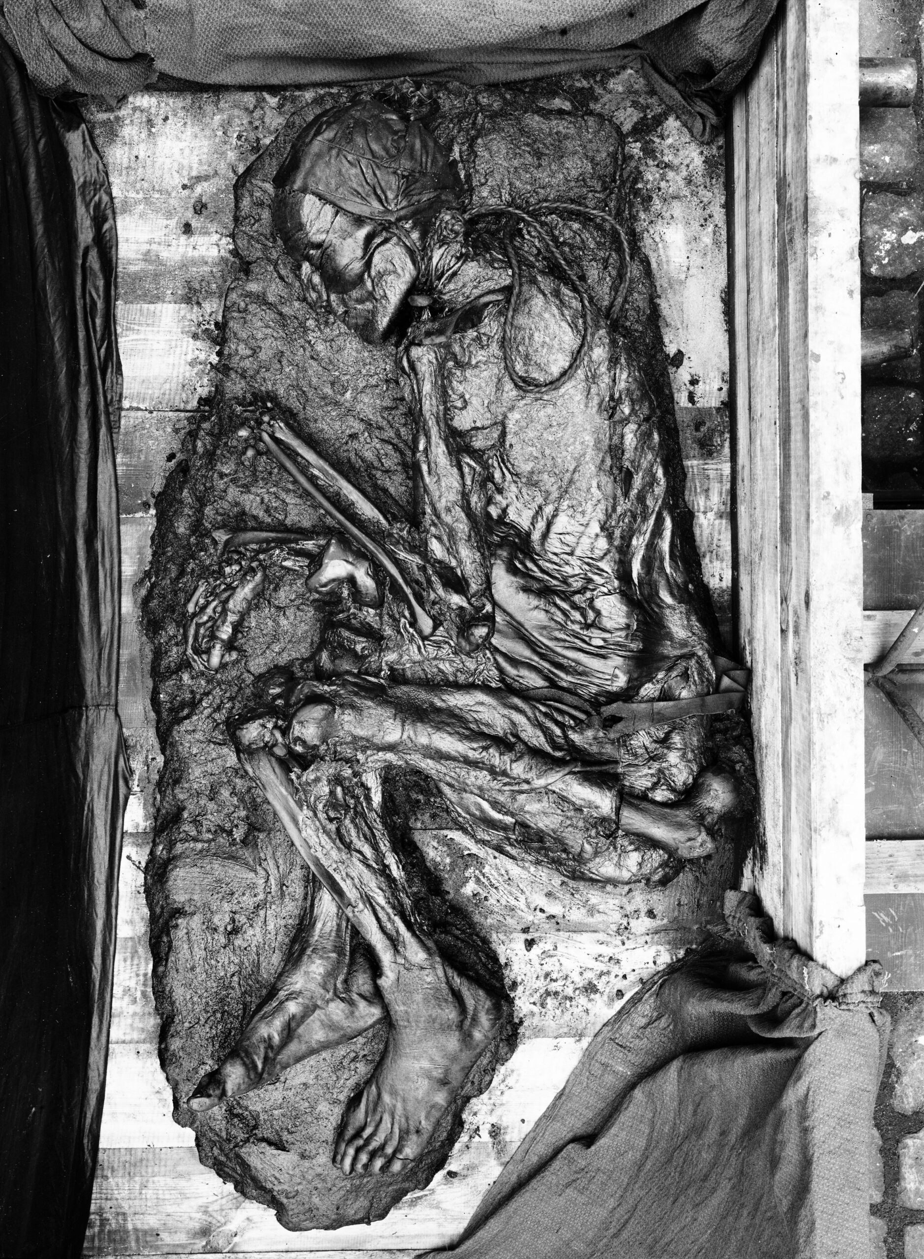 The well-preserved head of Tollund Man, an Iron Age bog body wearing a pointed leather cap.